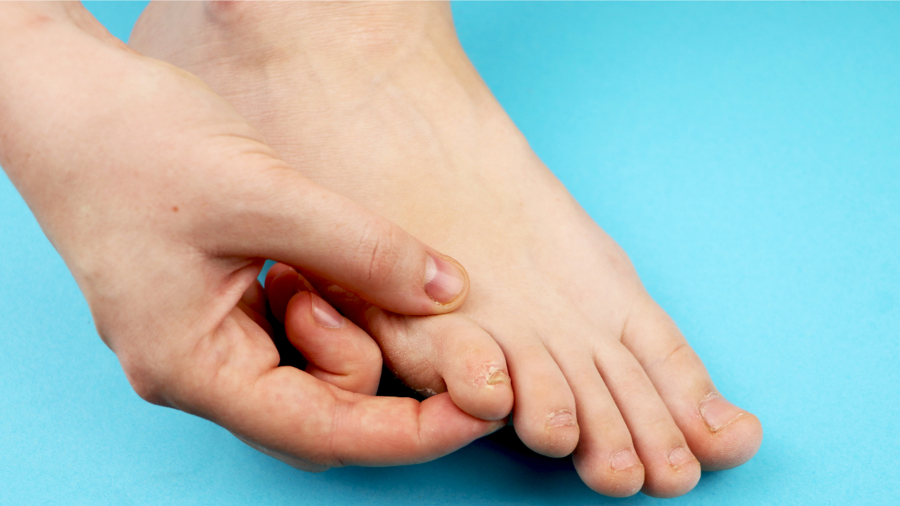 Die Verbindung zwischen Fußpilz und Fußgeruch
